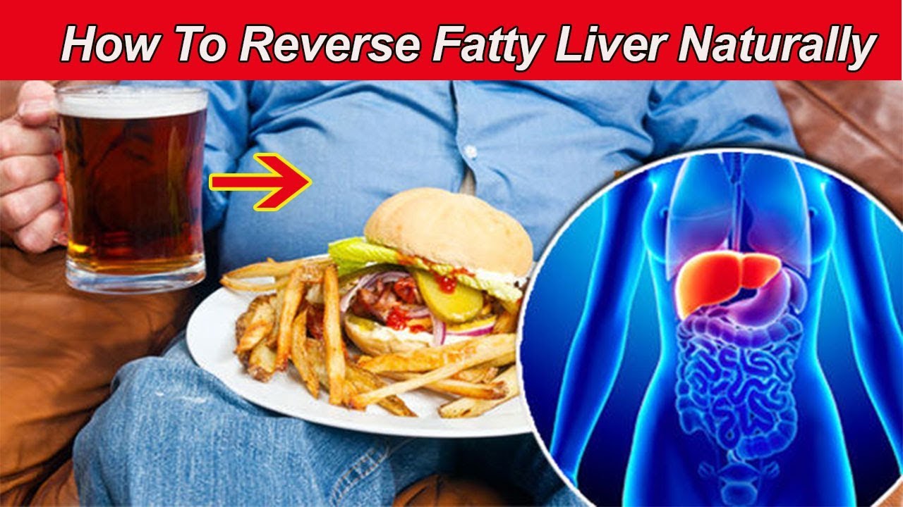 How To Reverse Fatty Liver Naturally Without Side Effects YouTube