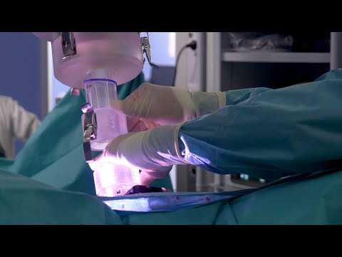 Primera cirugía robótica y radioterapia intraoperatoria para la recaída del cáncer de próstata