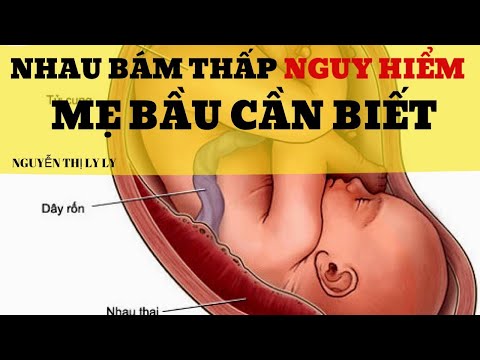 Video: Nhau Thai Thấp Nghĩa Là Gì?