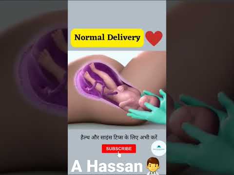 Normal Child Delivery !Baby Birth Shorts Youtubeshorts Viral