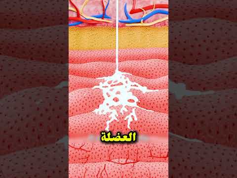 حقنة بدون إبرة اكتشف التقنية الجديدة حقنة بدون ألم تقنية حديثة علاج سريع