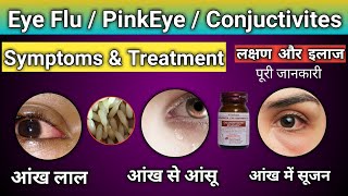 Eye Flu | Pink Eye | Conjunctivitis | Eye Flu Treatment |  Eye Flu Kaise Thik Karen | Pharma