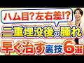 「やばい、腫れすぎ？」埋没二重のダウンタイムで絶対にやってはいけない5選