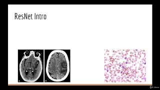 1  ResNet Section Intro