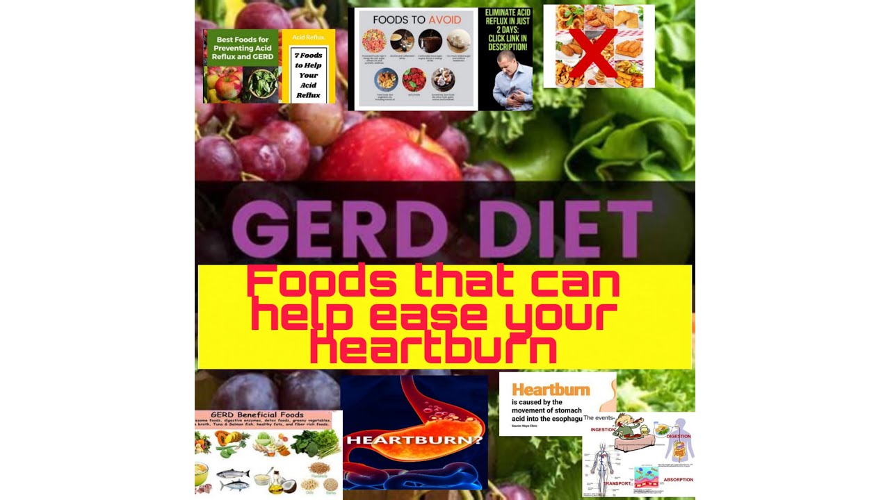 "GERD DIET Foods that can help ease your heartburn" / / DR. AMALIA S