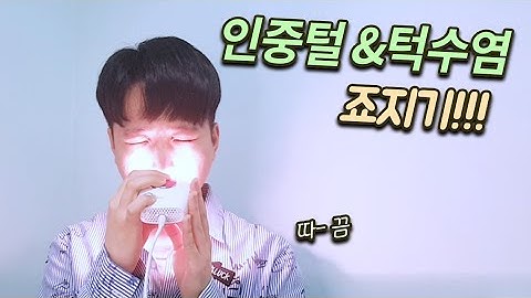 인중털·턱수염 제모하려고 가정용 레이저제모기로 지졌어요. / 레이저 제모 장단점 가격 ipl laser waxing hair removal burn 家庭用レーザー脱毛機レビュー