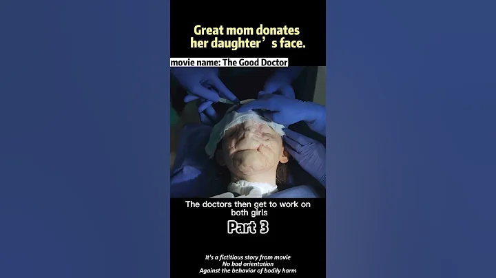 Great mom donates her daughter’s face. #films #movierecap #shortvideo #thegooddoctor - DayDayNews