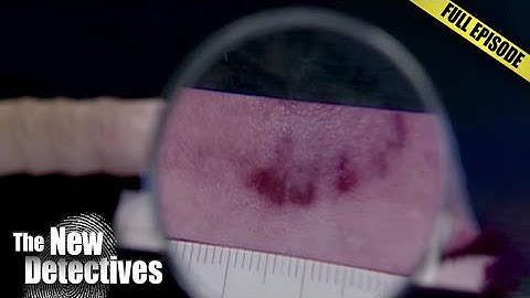 Bites That Solved Three Shocking Murders | The New Detectives
