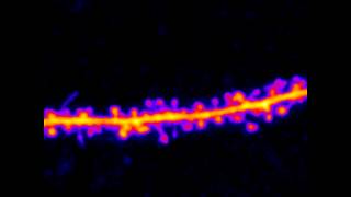 dendritic spines and filopodia