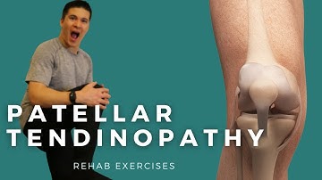 Exercise Progression for Patellar Tendon Pain (Tendinitis, Tendinosis, Tendinopathy)