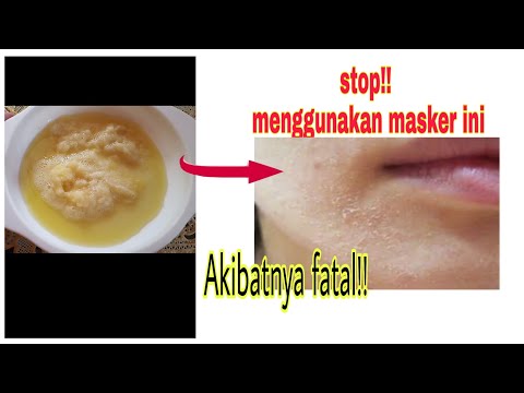 Video: Resep Kecantikan Kentang