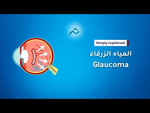   الجلوكوما المياه الزرقاء