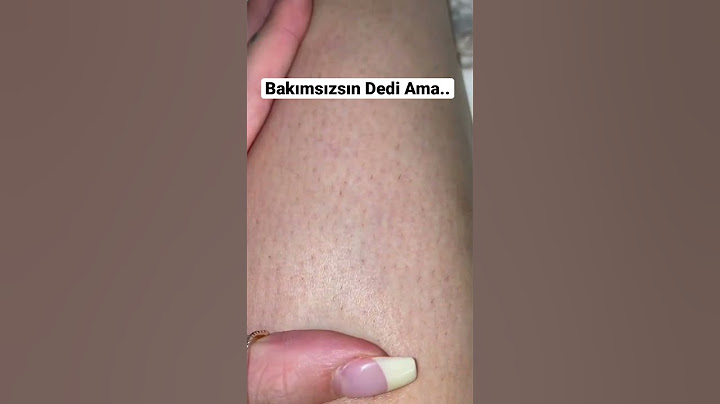 Çilek Görünümünden Kurtarıyor ??