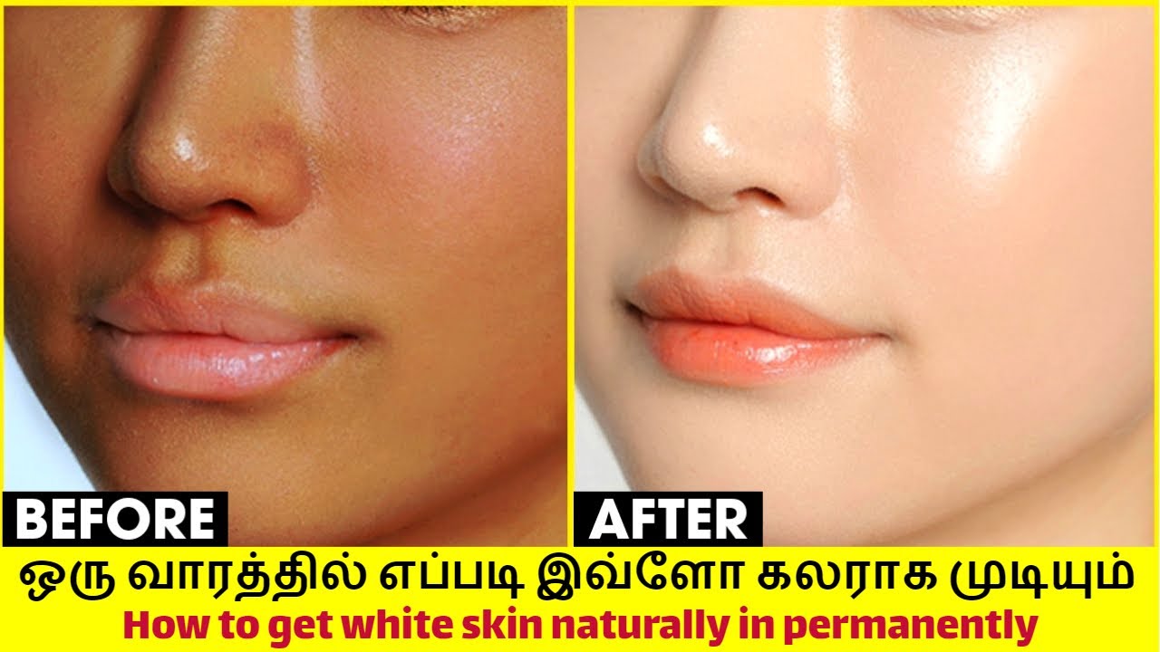 Skin Whitening 7 நாளில் உடல் முழுவதும் நிரந்தரமாக வெள்ளையாக FULL