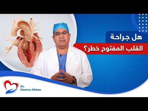 هل جراحة القلب المفتوح خطر دكتور اسامة عباس
