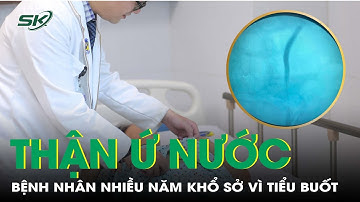 Tiểu buốt, đau hông lưng âm ỉ nhiều năm vì thận ứ nước | SKĐS