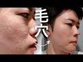 【毛穴 角栓 スキンケア】4年間使い続けて圧倒的に毛穴を改善した最強クリーム