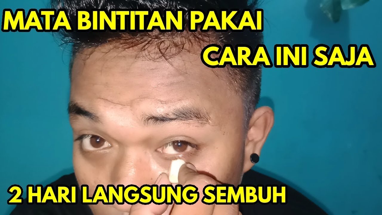 CARA INI SAJA MATA BINTITAN SEMBUH..!!cara mengobati mata bintitan