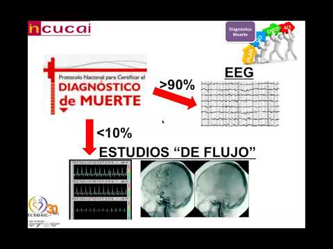 Diagnóstico de Muerte Encefálica - Dr. Diego Molina