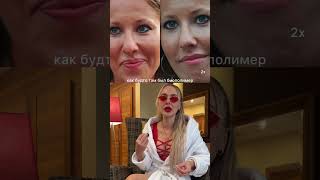 Разбор Собчак #ботокс #губы #обзор #косметолог #косметологмосква #косметологсочи