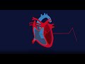 Understanding hypertrophic cardiomyopathy hcm