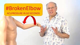 Broken Elbow