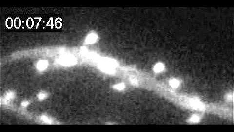 Mechanical forces make rat neurons dance