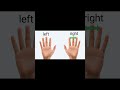 👉 Egawa’s Sign – Quick Test for Ulnar Nerve Palsy #meded #physicalexam #handpain #physio #atc
