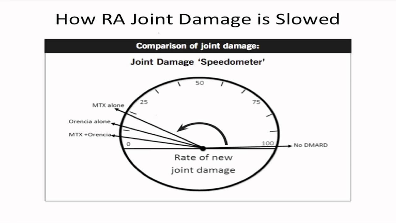 OA How RA is Slowed with Treatment