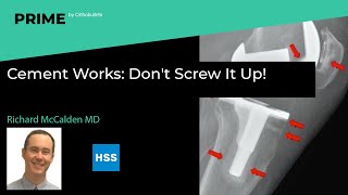 Cement Works: Don't Screw It Up! - Richard McCalden MD