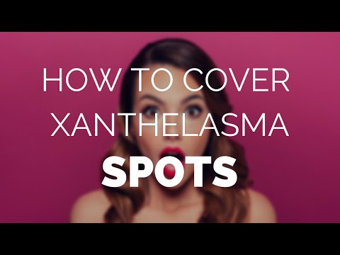 How to cover xanthelasma spots and remove them for good.
