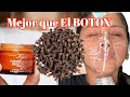 Esto es mas Potente que el Botox ✨ Con un poco eliminaras ARRUGAS🍃