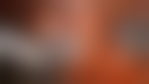 Robotic Partial Nephrectomy M Stifelman