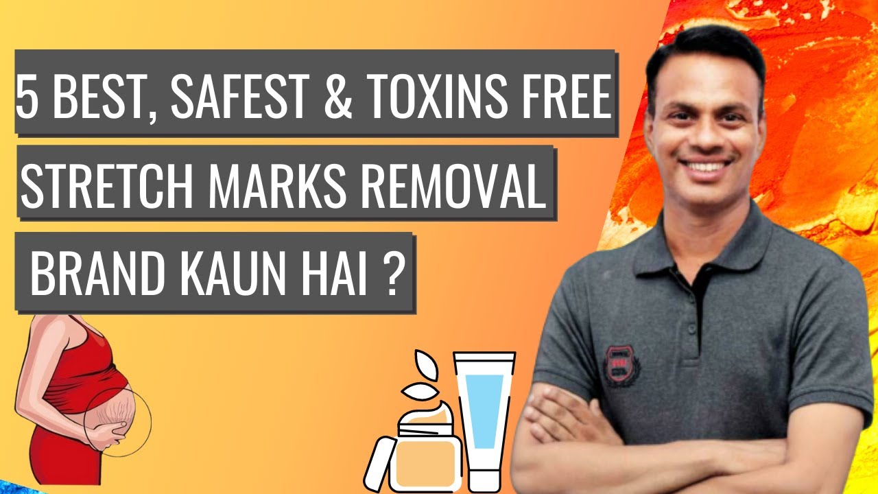 5 Toxins Free Best Stretch Marks Removal Cream / Oil in India? || Home Remedies || Xzimer Medicare