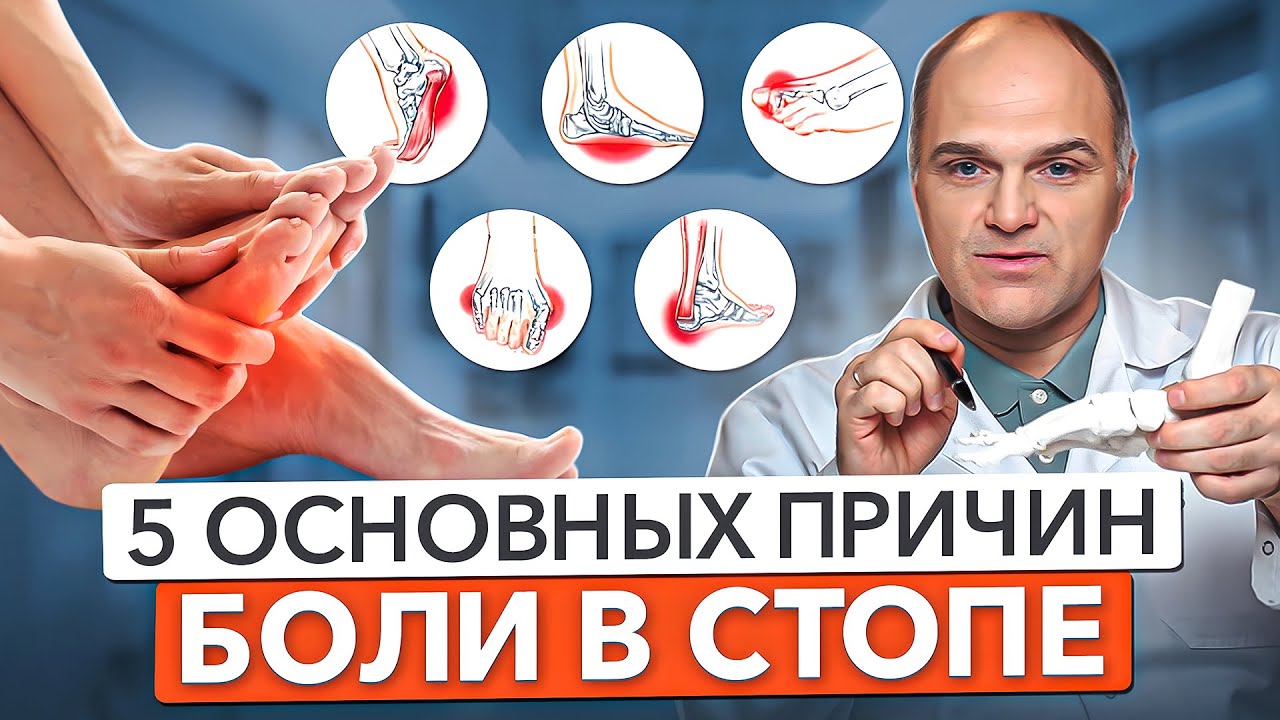 5 ОСНОВНЫХ ПРИЧИН БОЛЕЙ В НОГАХ. Почему болят стопы?