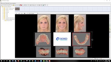 CS 3600 Orthodontic Records