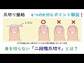 353「爪切りの援助 安全に切る4つのポイント」看護学生講座