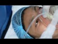 Girl Slowly Sleeping into Anesthesia