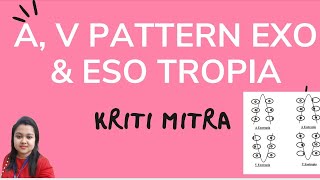 A and V Pattern EXOTROPIA and ESOTROPIA
