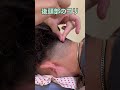 首こりの深層部に針をすると、音が鳴ります
