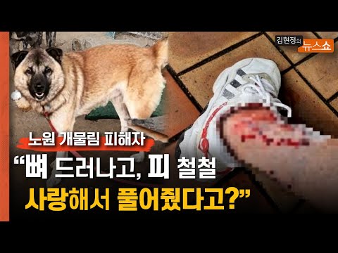 <strong>노원</strong> 개물림 피해자 &amp;quot;사랑해서 풀어줬다더니, 개는 맘대로 하라고&amp;quot;