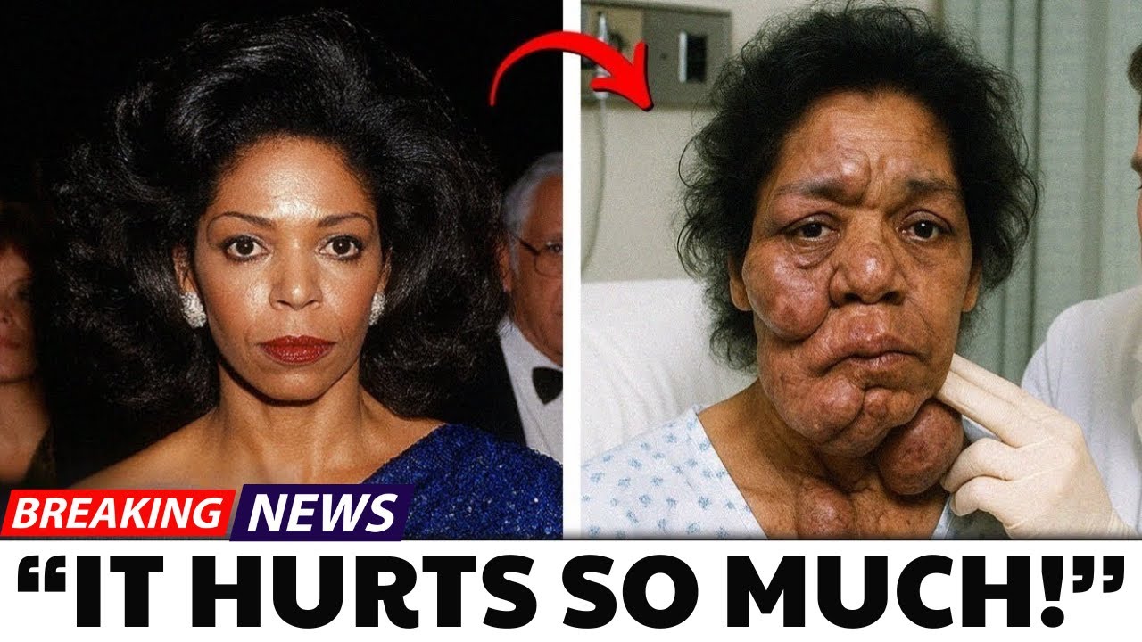 15 Black R&B Icons Who Lost Their Voices Due to Siceases - YouTube