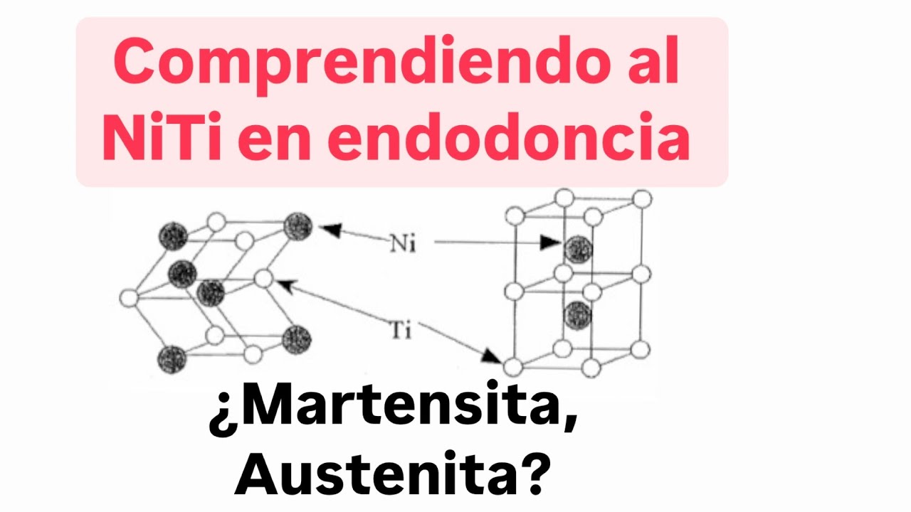 Aleaciones de NiTi en limas de endodoncia