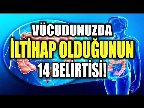 Vücudunuzda iltihap Olduğunun 14 Belirtisi! iltihap Sökücü Besinler