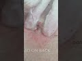The Most Effortless Back Pop You'll See