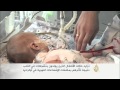 آلاف الأطفال يعانون من عيوب