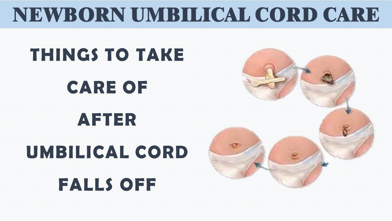 What To Do After Umbilical Cord Falls Off