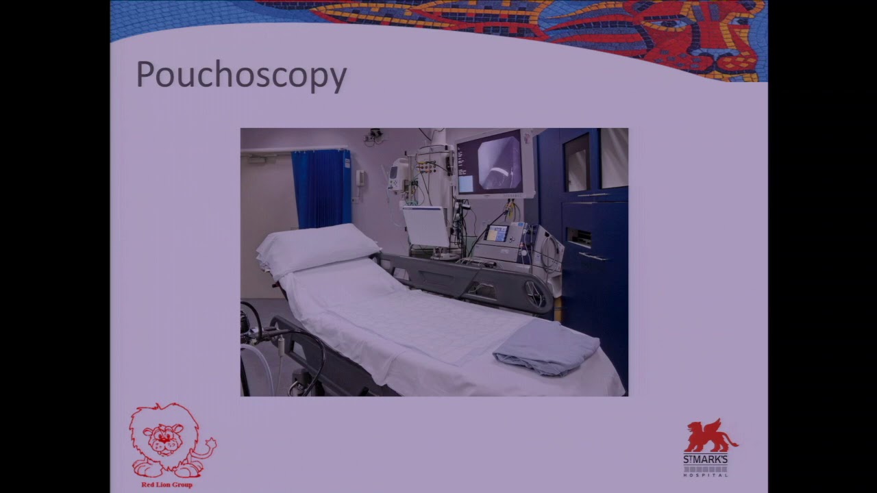 JPouch Surgery Complications Lisa Allison, St. Mark's Hospital. YouTube