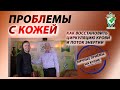 Проблемы с кожей. Нейродермит. Как восстановить циркуляцию крови. Руденко В.В. Академия Целителей.