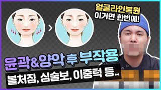 #양악 #안면윤곽 후 부작용 😭 해결 방법은? | #볼처짐 #심부볼 #이중턱 복원으로 고민해결 😆 | 강남 신사역 티오피성형외과